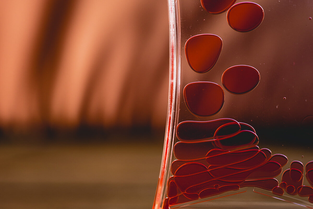 Qué es la trombosis y cómo prevenirla