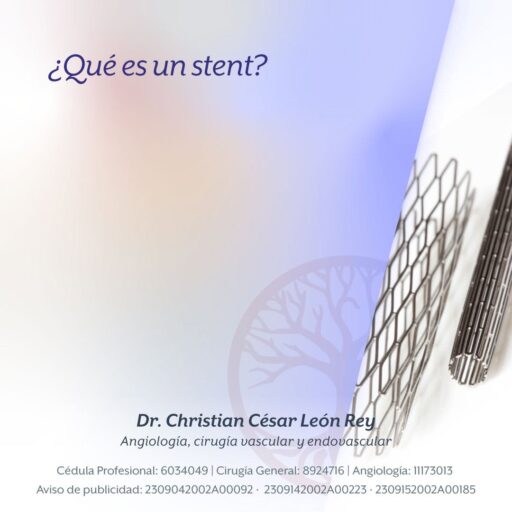 ¿Qué es un stent?